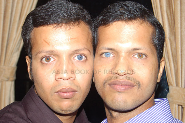 humans with different colored eyes